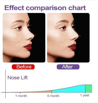 Nose Up Clip (Correction For Shaping Nose Tool)